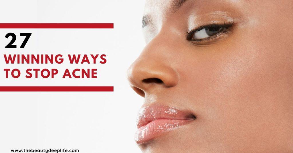 woman's face with text overlay - Winning Ways to Stop Acne