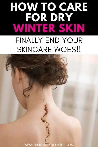 woman with skin exposed and a crack on her back with text overlay - How To Care For Dry Winter Skin
