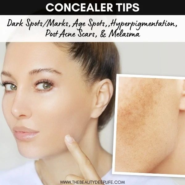 woman with discoloration on her cheek and with makeup after using concealer