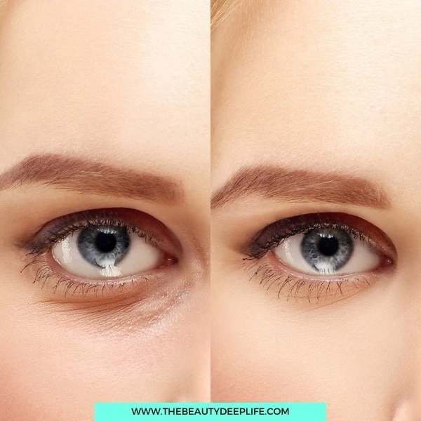 woman's eye before and after using concealer for dark under-eye circles